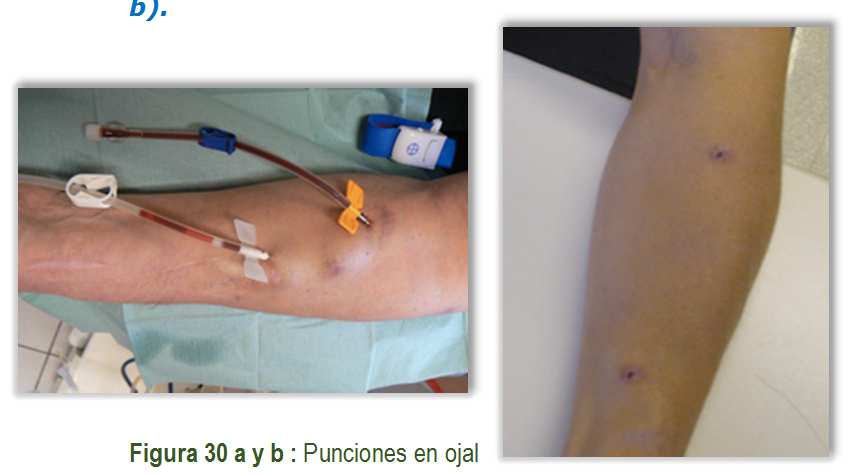 Figura