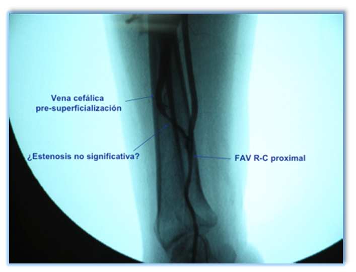 Figura