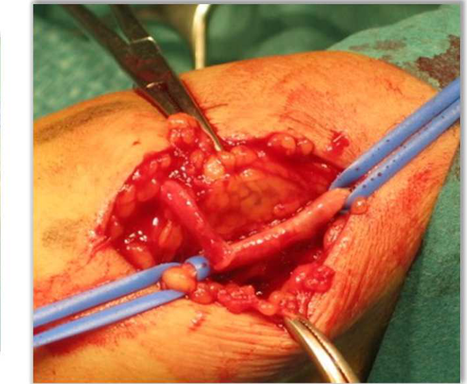 Figura