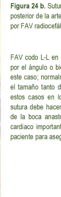 Figura