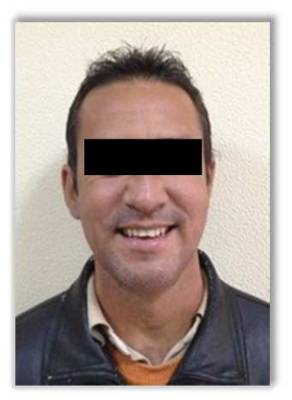 Figura